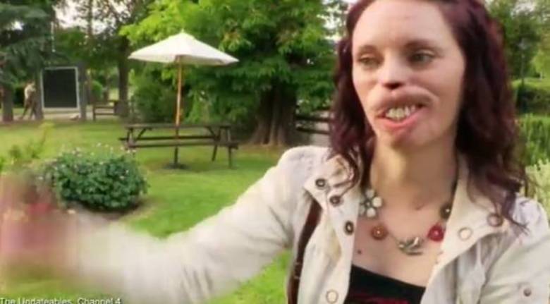 No entanto, o programa, que entrará nessa semana na sua 5ª edição, foi criticado por muitos médicos. A drª Rachael Pickering, por exemplo, se mostrou revoltada com este tipo de entretenimento 

Conheça o R7 Play e assista a todos os programas da Record
na íntegra!

 