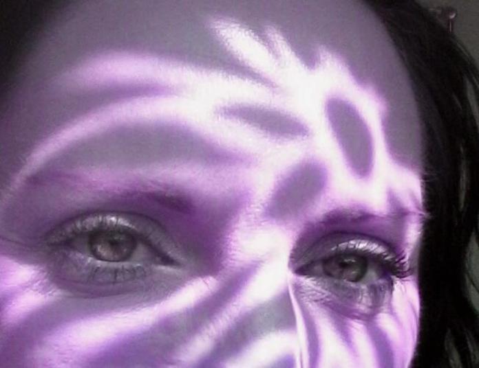 Os sintomas são próprios de infecção bacteriana: dores no corpo, tosse, dor de cabeça, febre alta, fraqueza e vômitos. Além desses, podem ocorrer queda de pressão, convulsões e lapsos de consciência. Manchas arroxeadas também podem aparecer, por causa da hemorragia