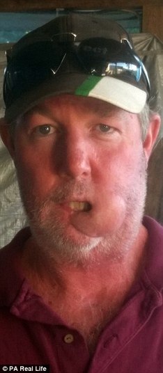 Lisle agora está em recuperação. As operações (outras se seguiram) ocorreram no Hospital Princesa Alexandra, em Bisbane, a seis horas de sua cidade. Seus filhos ficaram com os avós e a esposa, mesmo deprimida, o acompanhouPesquisadores ingleses descobrem que vírus do resfriado comum pode curar câncer