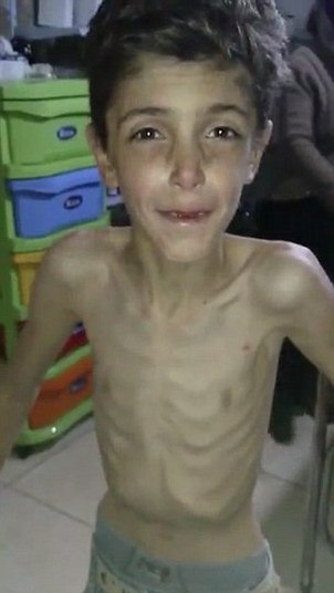 A cidade em que crianças estão morrendo de fome no oeste da Síria vai finalmente receber ajuda humanitária, após as imagens da população esquelética rodarem o mundo