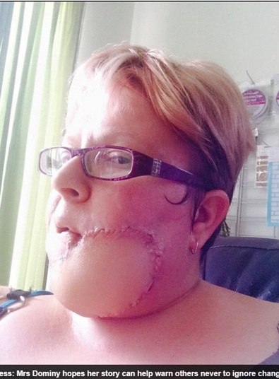 Então, a mulher foi submetida a uma cirurgia no rosto e acabou
perdendo queixo e o lábio inferior. Foram nove horas de operação, que deixou 170
pontos. Jodie ainda  precisará passar por mais procedimentos para reparar os danos ao seu rosto 