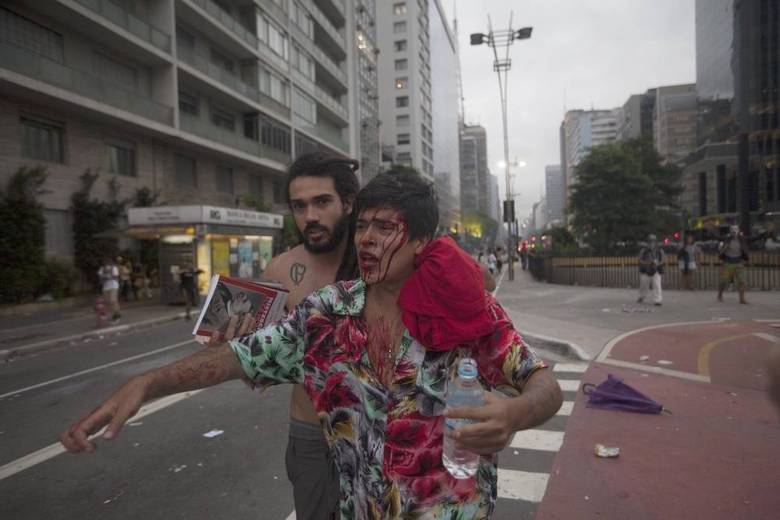 Acima, manifestante ferido após ação da PM. Eber Veloso Carlos, que é metroviário, disse ter sido agredido por um PM com um cassetete.