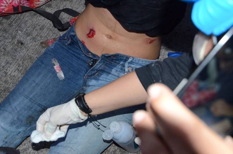 Um repórter fotográfico também foi ferido na região da Paulista e esperou por cerca de uma hora, a procura de táxis ou outros motoristas para ser levado a um hospital. Um ambulância acabou socorrendo o jornalista, que foi para o Hospital das Clínicas