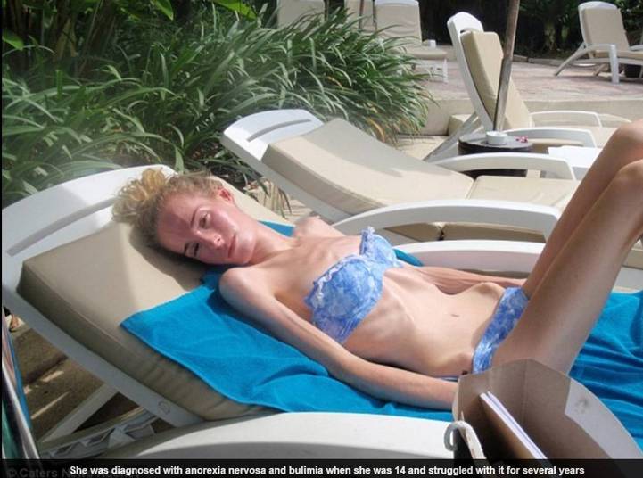 O pai dela, Steve, revelou à publicação que rever as
fotos de sua filha magra traz angústia e dor