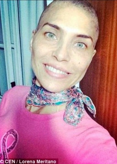 Lorena inspirou muitas argentinas que sofrem com a doença ao
postar fotos careca durante a quimioterapia
