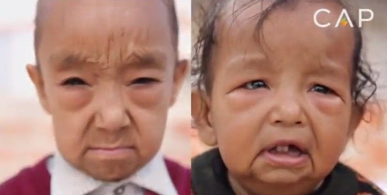 Anos depois eles tiveram Keshav, com a mesma condição e, por não terem dinheiro, nem procuraram o médico para o filho, segundo a mãe

Conheça o R7 Play e assista a todos os programas da Record
na íntegra!

 