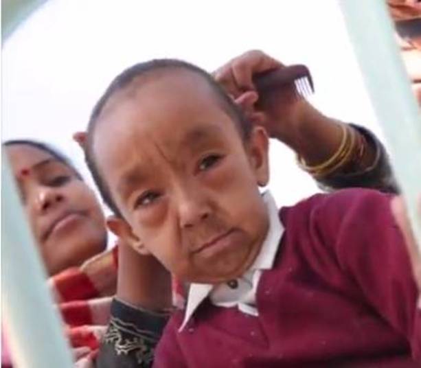 — As pessoas em nossa comunidade os chamam de 'velhos' e é de partir o coração. Tentamos obter ajuda de nossos médicos locais, mas eles nos disseram que a nossa única esperança é um tratamento no exterior