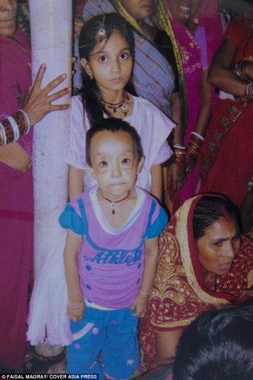 — Nós a levamos ao nosso médico de um hospital do governo, recebemos a informação de que não havia cura para ela e que sua vida estava nas mãos do SenhorBebê sofre de doença rara e precisa de ajuda para tratamento fora do país