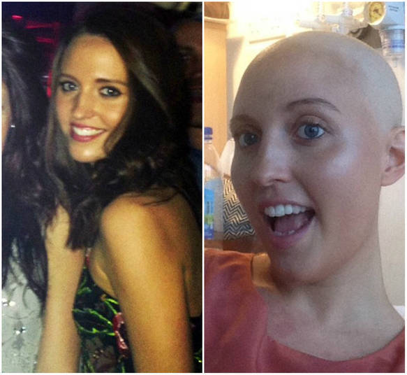 Uma jovem britânica conviveu durante meses com fortes dores nas pernas. Ela acreditava que o sintoma era causado por seu hábito de dançar de salto alto todas as noites — mas ficou chocada ao descobrir que o que causava as dores era algo muito mais sério: ela tinha leucemia