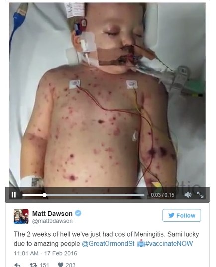 Inspirado na história de Faye e sua família, foi criada uma petição online reivindicando a gratuidade da vacina para as crianças da Inglaterra