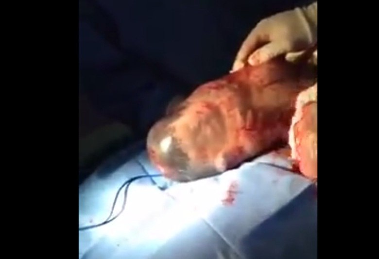 O incrível momento em que um bebê nascido dentro da bolsa amniótica respira pela primeira vez é gravado. O vídeo foi publicado no Facebook de Jasmine Perez