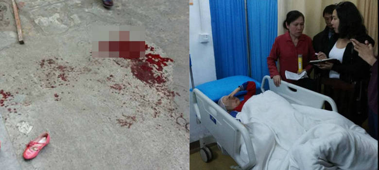 Dez alunos de uma escola primária localizada na cidade de Haikou, no sul da China, foram atacadas nos portões da escola por um homem com uma faca. Duas das vítimas ficaram gravemente feridas e permanecem no hospital