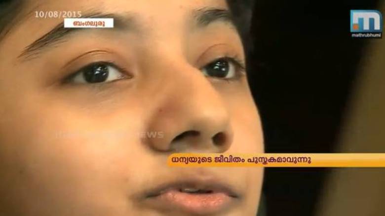 A moça, natural de Bangalore, Índia, tem uma doença genética, incurável, denominada Osteogenesis Imperfecta. Em geral, ela fratura um osso por mês. Em sua vida, sofreu um total de 300 fraturas