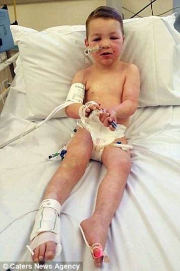 Tammy contou que, como desconhecia a doença, entrou em contato com o instituto Stevens Johnson Awareness, no Reino Unido, e teve todo o suporte de que precisava. Segundo ela, os especialistas foram muito prestativos e realmente se preocuparam em saber sobre a evolução do quadro de Joel.— Estou tão orgulhosa por meu filho ter conseguido superar algo tão complicado. Não consigo acreditar no quão perto estávamos de perdê-lo