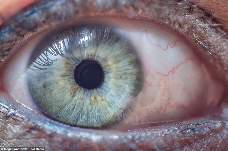 A íris azul desta modelo aparece salpicada com manchas amareladas e linhas que vão do centro para as bordas