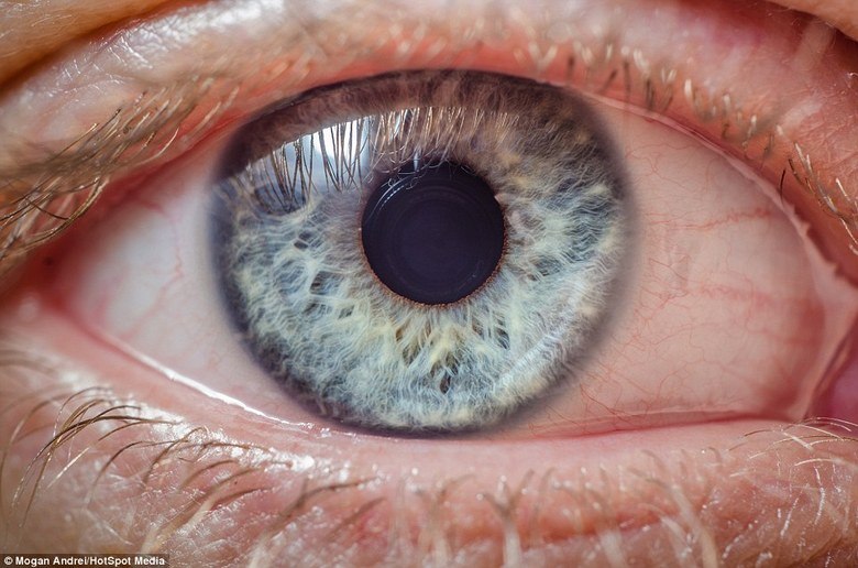 Para isso, ele utiliza uma lente especial, para captar os pequenos detalhes da imagem