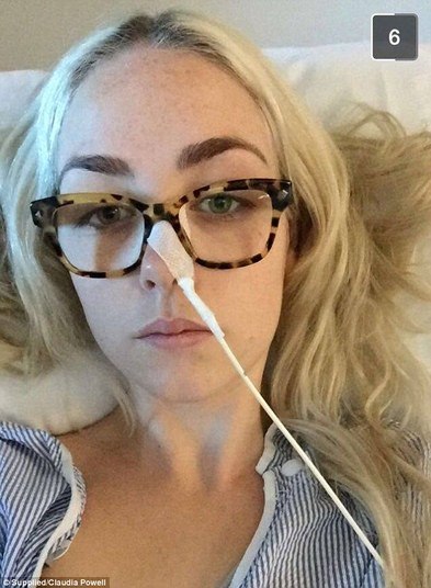 Apesar de não estarem relacionadas, a endometriose e a síndrome de Pots acabam agravando os sintomas uma da outra. A Pots é uma disfunção no sistema nervoso autônomo, não tem a ver com o sistema reprodutor. Vítima de ambas as doenças, Claudia não apenas sofre de cólicas intensas diariamente como fica refém de cadeiras de roda sempre que vai sair.Para piorar, a jovem também foi recentemente diagnosticada com gastroparesia — uma condição que impede o esvaziamento do próprio estômago e faz com que ela precise se alimentar por meio de um tubo