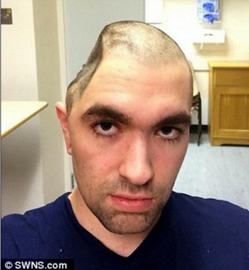 Mas, quase um ano depois do incidente, ele já consegue andar com a ajuda de uma tala nas pernas e uma bengala. Com isso, ele sonha em voltar a correr em breve.— Eu quero voltar ao mundo fitness. Faço exercícios todos os dias agora. O objetivo é voltar a correr(Com informações do Daily Mail)