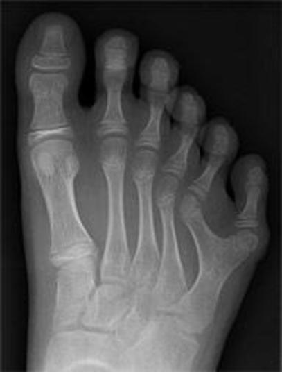 O problema em si não gera riscos à saúde ou à vida, mas o estigma causado pela anomalia pode gerar traumas e atrapalhar no dia-a-dia da pessoa 

Conheça o R7 Play e assista a todos os programas da Record
na íntegra!

 