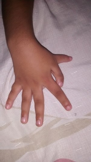 Mas algumas instituições de caridade já se mostraram interessadas em colaborar, já que a cirurgia é muito cara, com o valor variando de R$ 54.000,00 a R$ 270.000,00