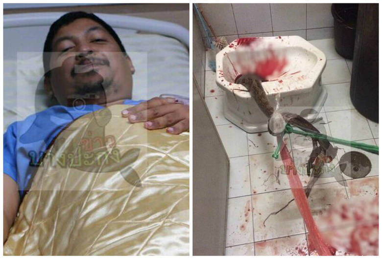 Um homem se viu em meio a uma briga com uma cobra gigante que deslizou pela tubulação de esgoto até o vaso sanitário de sua residência em Bangkok, na Tailândia