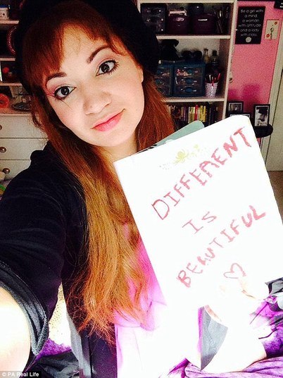 — Apesar da doença, estou envolvida na vida. Quero terminar minha faculdade, entendendo que essas anomalias fazem parte de mim. Quero que as pessoas entendam que sou diferente, mas que essa diferença é bonita — afirma, esperançosa.Agora Arianna está namorando e, apesar de ainda ser virgem, afirma que está levando o relacionamento com calma, por causa das dores constantes