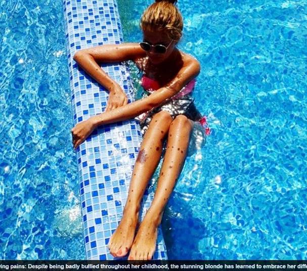 Porém, hoje em dia, ela afirma que estava 'otimista' e 'tinha aprendido a não prestar muita atenção a esses comentários'