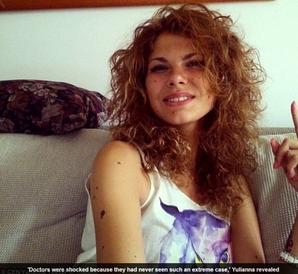 Em resposta a uma imagem da morena posando com as marcas de nascença, uma menina comentou: 'Nossa, você é uma menina linda e especial. Respeito' 