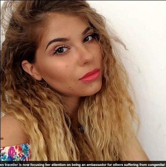 Uma outra disse: 'Você tem uma pele ótima. As pessoas que têm pele diferente são únicas e não devem ter vergonha'