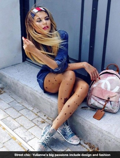 Segundo ela, como 'havia um monte de manchas por todo o meu corpo eles disseram à minha família que eles não sabiam quanto tempo eu ficaria viva.' Yulianna disse que, na época, os médicos lhe deram apenas horas de vida.