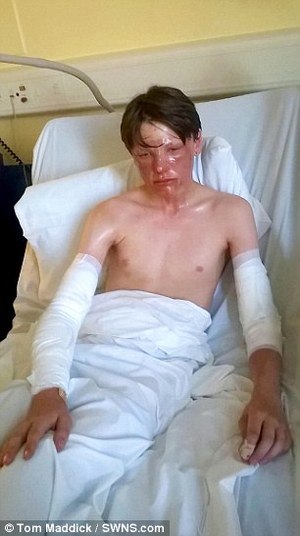 'Kyle foi azarado, mas seus ferimentos poderiam ter sido muito piores', disse o pai do menino, Wayne ROund(Com informações do Daily Mail)