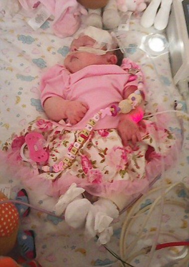 Quando a menina nasceu, os médicos diagnosticaram
que havia contraído meningite e disseram à família que não sobreviveria mais que
alguns dias. No entanto, Tiger-Jade superou as expectativas de todos e já
completa seis meses de idade. Nos primeiros seis minutos da vida da criança, ela menina não respirava, o que fez com que os médicos a colocassem às pressas em
um respirador artificial 