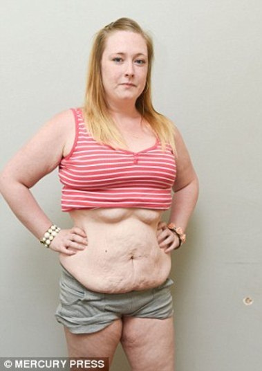 — O que mais me frustra é ter que abandonar meu trabalho. Eu amo
trabalhar, amo sair, e agora não posso fazer mais nada. Não posso comer glúten
nem alimentos com lactose, álcool então, nem pensar. Olho para meu calendário e
preciso me preparar para as crises