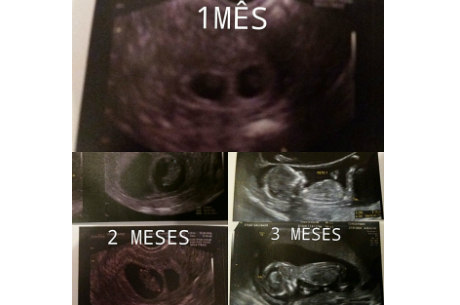 Ultrassom dos filhos de Pepê