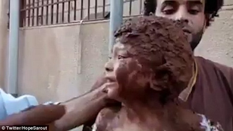 No domingo (28), o vídeo de uma criança se contorcendo em agonia enquanto um grupo de homens tentam apaziguar sua dor foi divulgado pelo Centro de Mídia de Homs