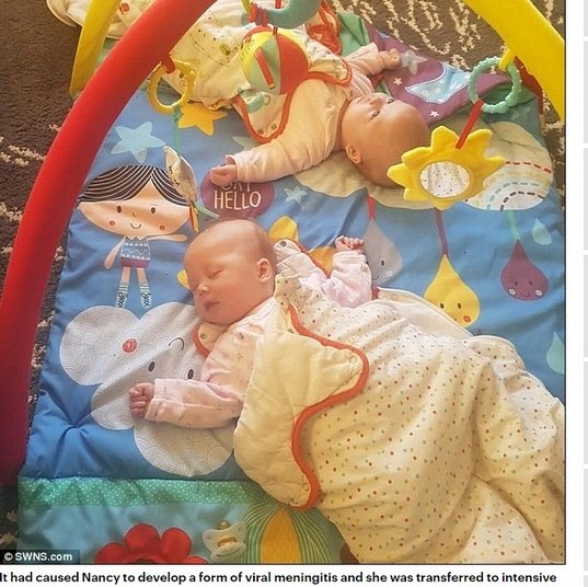 — Nós nunca poderíamos imaginar que isso aconteceria. Por algumas razões genéticas, as gêmeas contraíram meningite no útero. Elas tiveram uma reação terrível. É uma sorte elas estarem vivas 