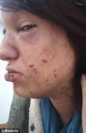  Foi uma atitude chocante e covarde. Na verdade, ele colocava na moça toda a sua frustração, mostrando que não sabia lidar com suas próprias atitudes:— De repente, Jamie me deu um soco que me jogou no chão e colocou as mãos em volta da minha garganta