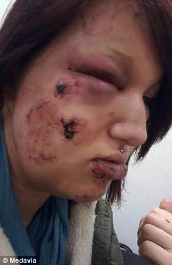 Chamou a ex para uma conversa sobre o relacionamento e deixou extravasar seu instinto brutal, assumindo seu lado criminoso. Saltou em cima da jovem, e a socou, tentando esganá-la