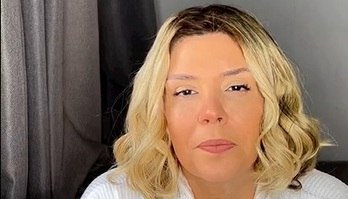 Simony desmente boatos de que câncer se espalhou pelo corpo: 'Parem de me matar' (Reprodução/Instagram)