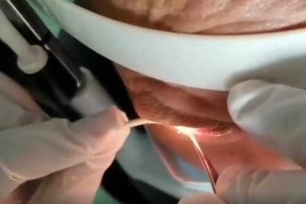 A doença é transmitida por meio de moscas contaminadas, que se alimentam das secreções produzidas pelos olhos de cães, gatos e humanosLeia mais!&nbsp;OVNI faz manobra 'jamais vista' perto da Estação Espacial Internacional