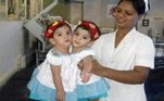 As irmãs gêmeas siamesas Aradhana e Stuti, de 13 meses, nasceram unidas pelo peito e, em junho foram separadas em uma cirurgia que durou 12 horas