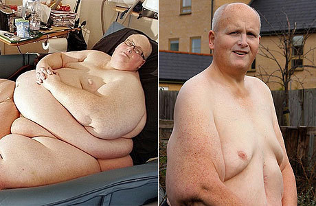 Paul Mason conseguiu eliminar 286 quilos com cirurgia de estômago