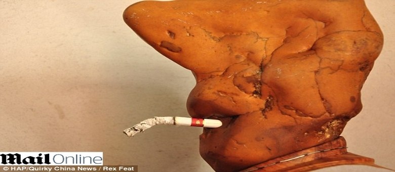 O Ministério da Saúde adverte: fumar causa problemas, inclusive em pedras
