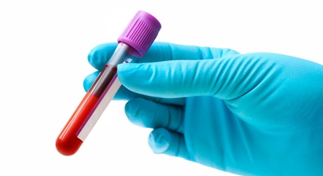 No ano passado, foram registrados 40,1 mil novos casos de hepatites no Brasil