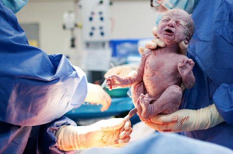Grávidas podem escolher anestesia até no parto normal, sugere lei