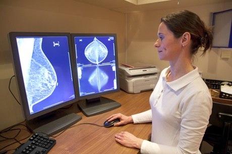 Mulheres de mais de 40 anos poderão fazer mamografia gratuitamente