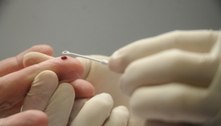 Profissionais são capacitados para teste rápido de sífilis e HIV na rede pública de saúde