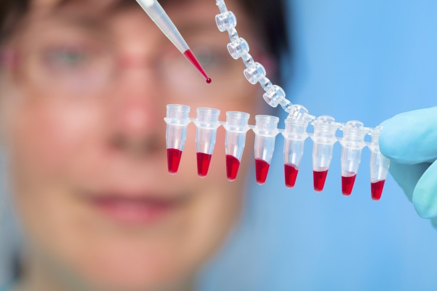 Testes para detectar infecções sexualmente transmissíveis podem ser feitos rapidamente no SUS