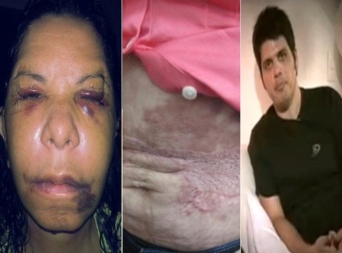 

Clínicas baratas, falsos médicos e a pressa
pela correção de imperfeições no corpo é a receita para que uma
cirurgia plástica se torne desastrosa. Matérias publicadas no R7 mostram que erros podem causar grandes tragédias na vida de quem desejava
ter um corpo ou um rosto mais bonito. Veja casos!