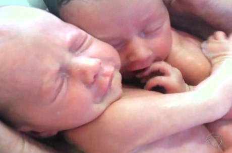 Tecnica De Banho Usada Em Gemeos Que Se Abracaram Facilita Adaptacao Fora Do Utero Dizem Especialistas Recordtv R7 Domingo Espetacular
